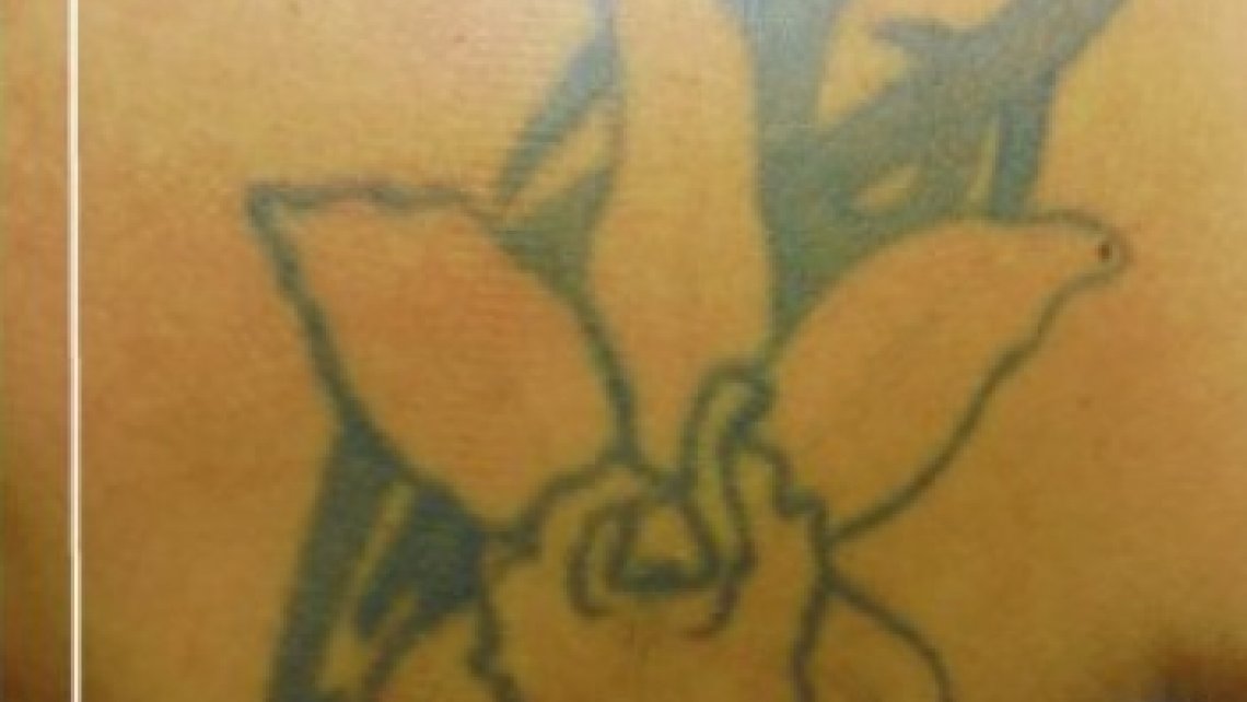 Copertura tatuaggi esistenti a cura di Dr. Zivago Tattoo