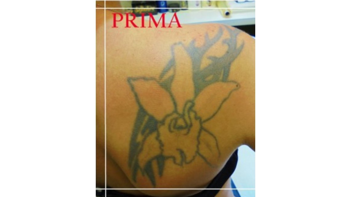 Copertura tatuaggi esistenti a cura di Dr. Zivago Tattoo